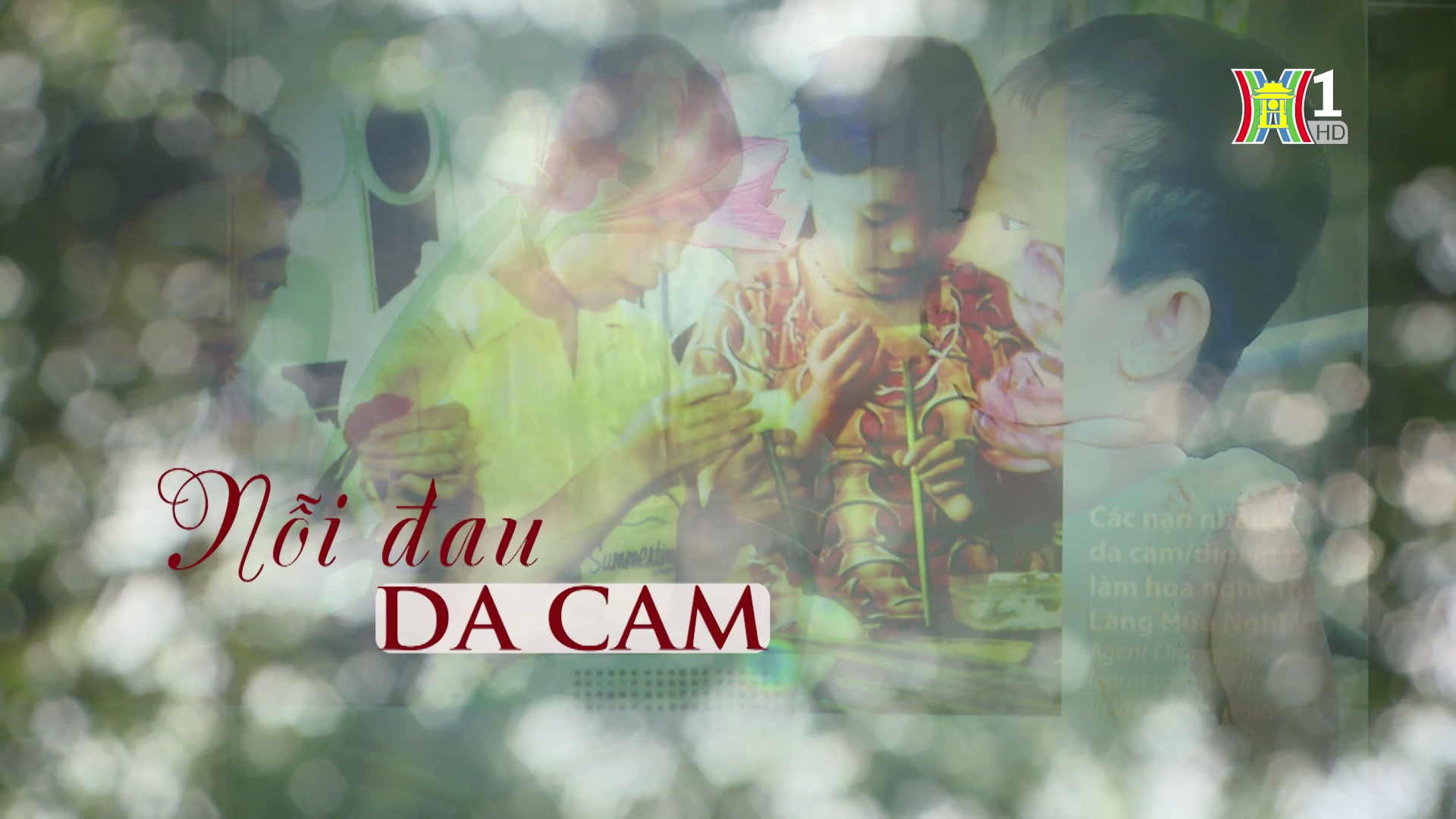 Nỗi đau da cam | Phóng sự tài liệu | 23/07/2024
